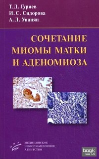 Сочетание миомы матки и аденомиоза