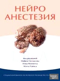 Нейроанестезия