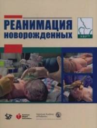 Реанимация новорожденных