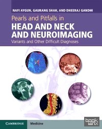 Pearls and Pitfalls in Head and Neck and Neuroimaging: Variants and Other Difficult Diagnoses