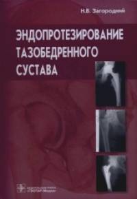 Эндопротезирование тазобедренного сустава: Основы и практика. Руководство