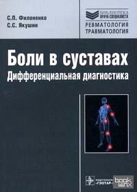 Боли в суставах: дифференциальная диагностика