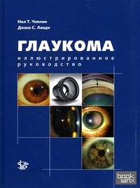 Глаукома: Иллюстрированное руководство