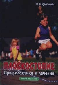 Плоскостопие: Профилактика и лечение