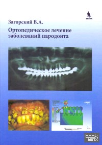 Ортопедическое лечение заболеваний пародонта